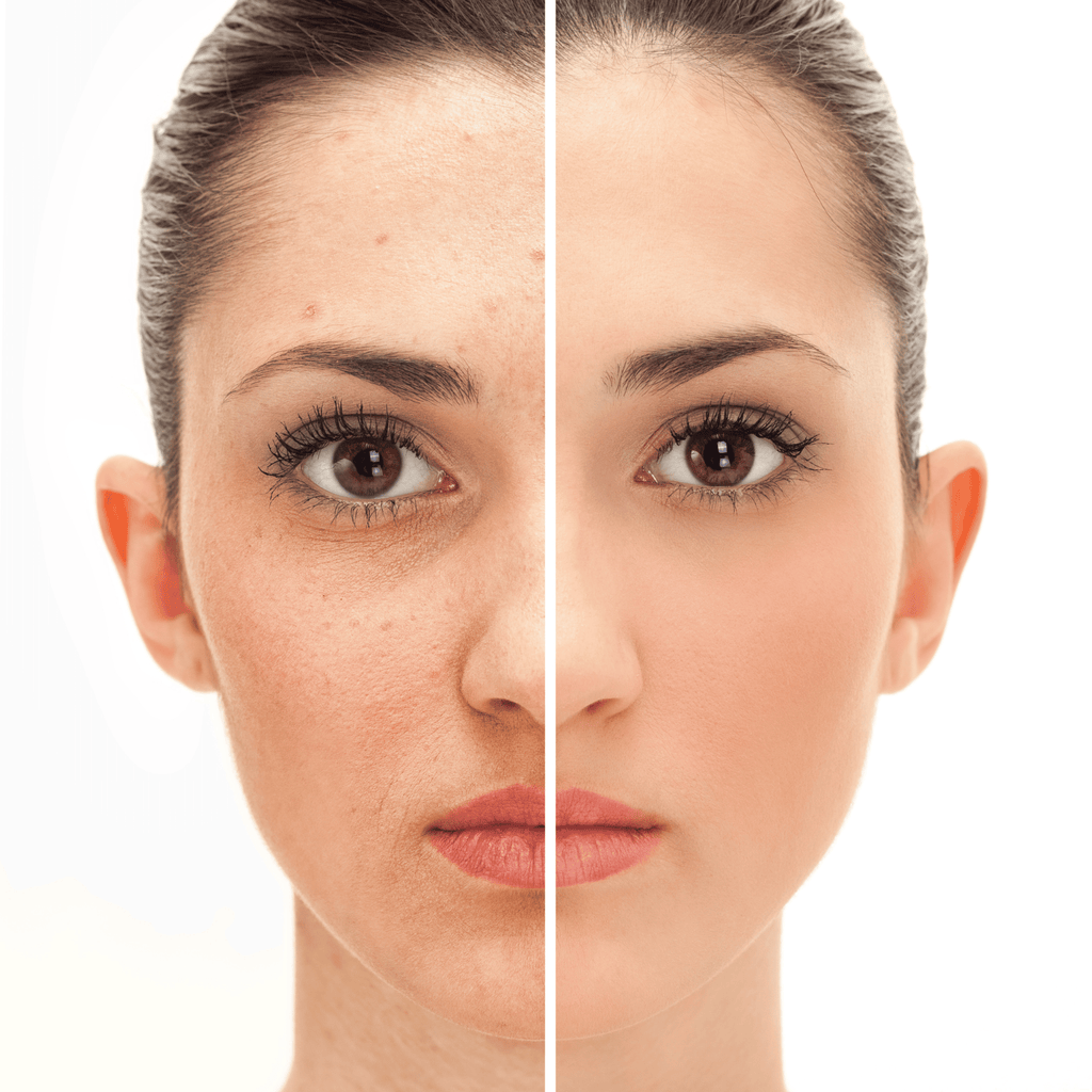 GlowPro – Micro LED Lichttherapie