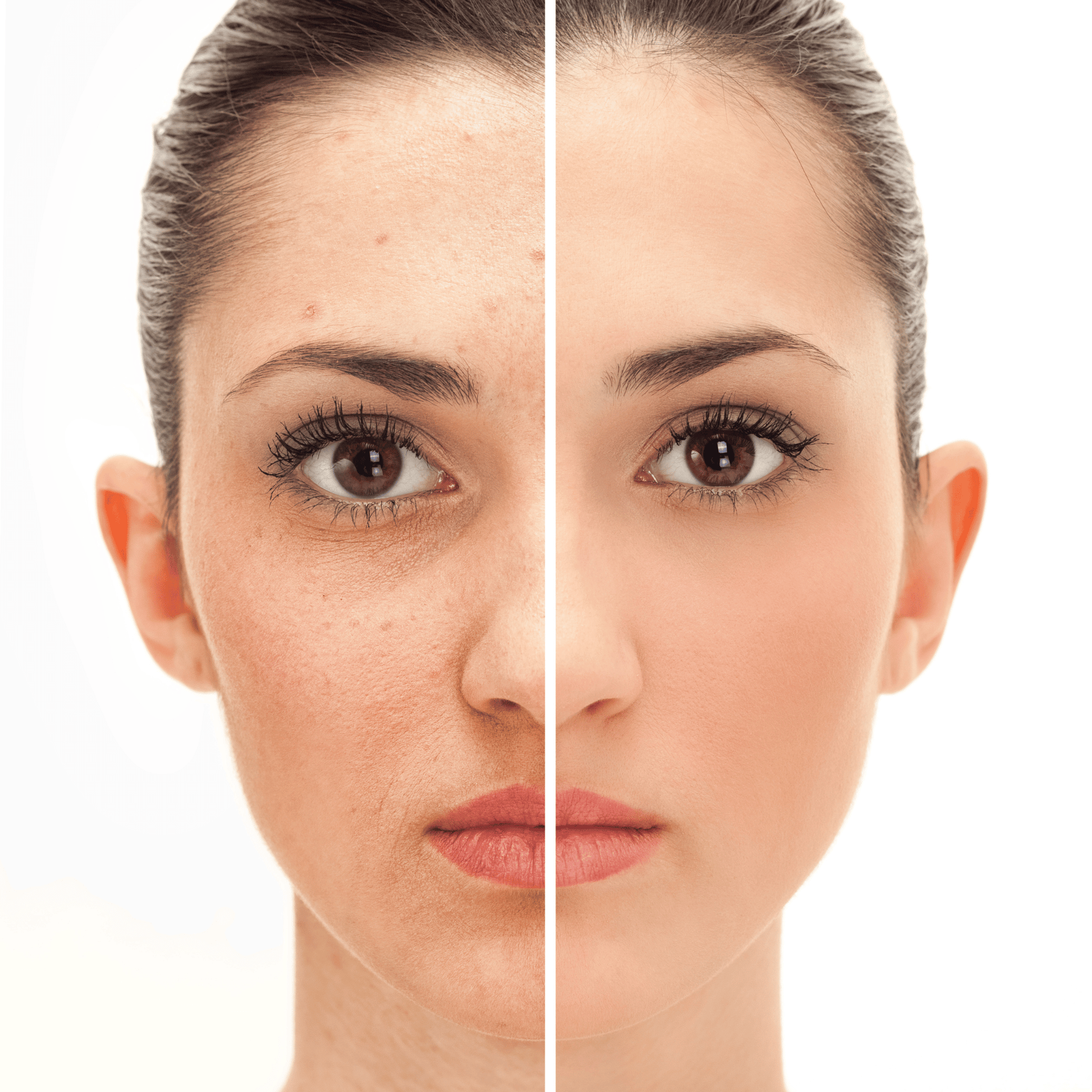 GlowPro – Micro LED Lichttherapie